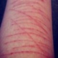 Mums Against Self Harm